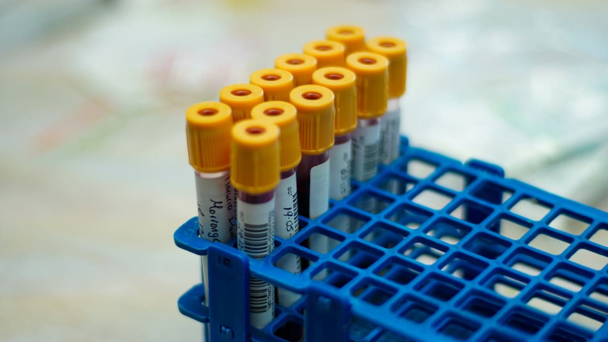 Los individuos con sangre tipo B tienen una mayor capacidad de adaptación