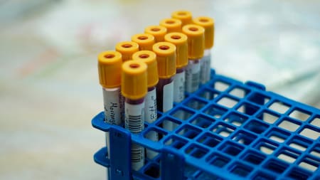 Un envejecimiento más lento: cuál es el grupo sanguíneo que ayuda a una mayor longevidad