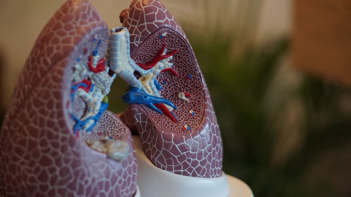 Día Mundial de la Neumonía: cuáles son sus síntomas y cómo prevenir la enfermedad