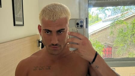 El sucesor: Tomás Holder se hizo una cirugía estética y en las redes sociales lo compararon con Ricardo Fort