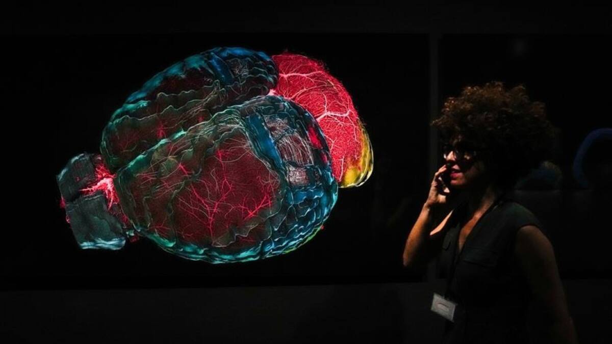 Cerebro. Foto EFE.