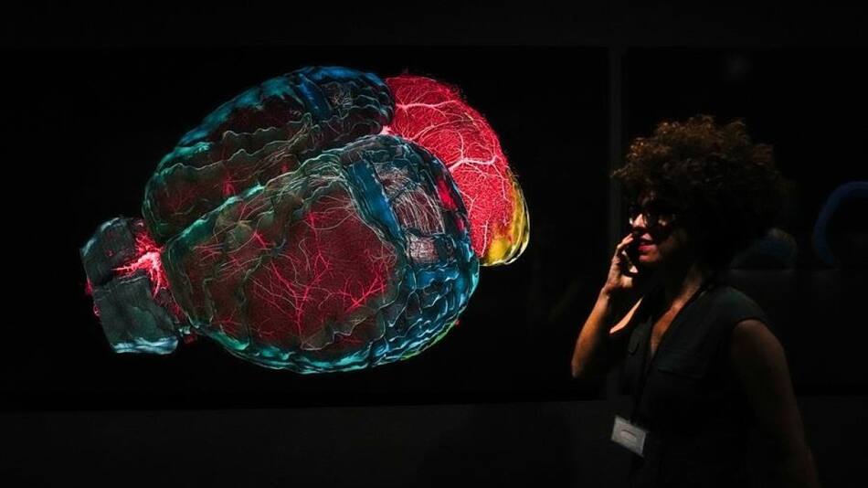 Cerebro. Foto EFE.