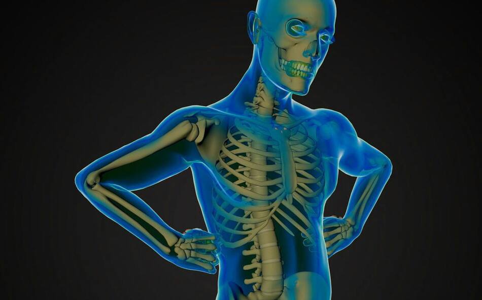 Esclerosis multiple