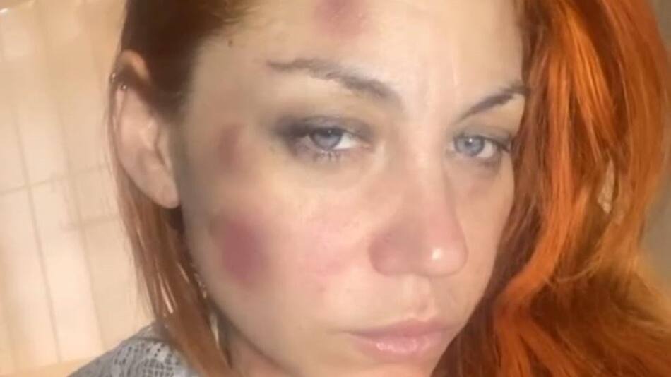 Lourdes de Bandana denunció un ataque de violencia de género. Foto: Instagram.