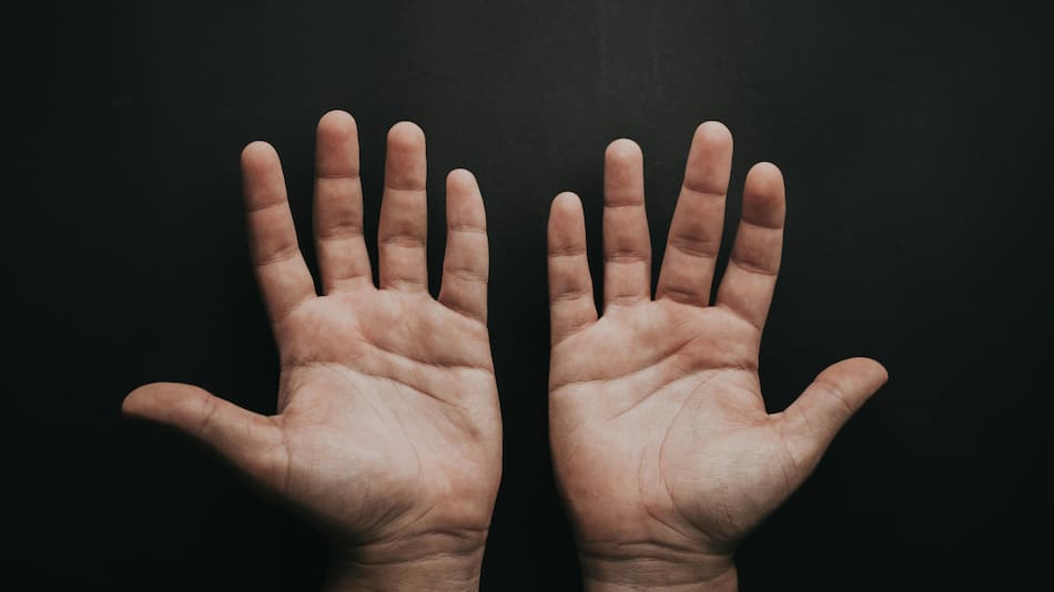 Manos. Foto: Unsplash