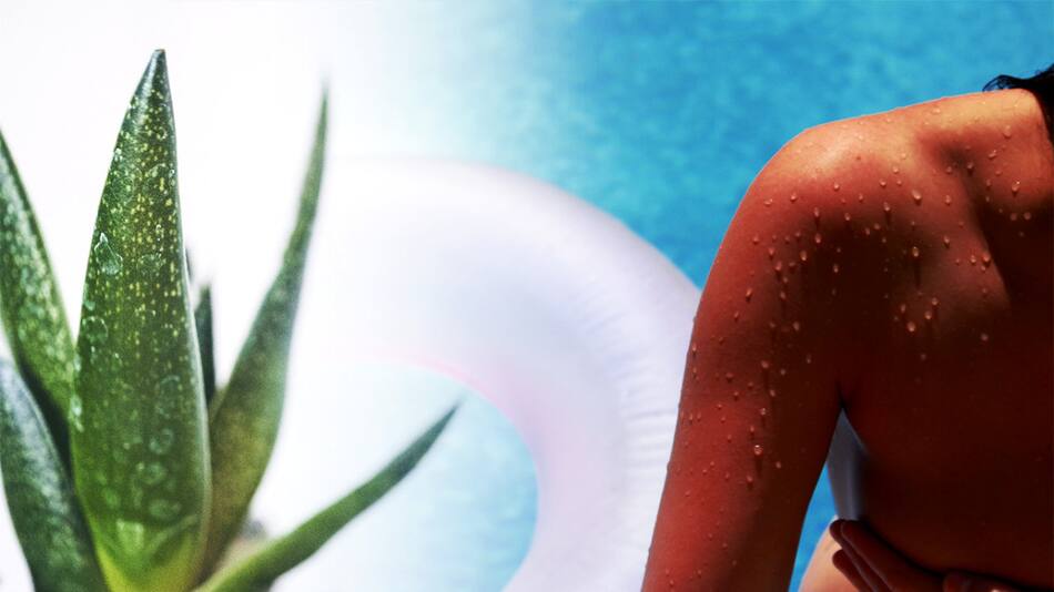 Aloe vera. Foto: Pexel