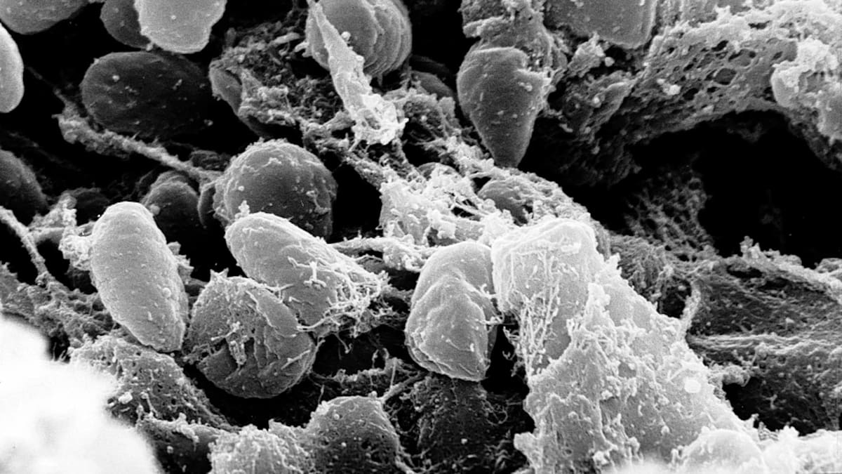Microfotografía con microscopio electrónico mostrando bacterias Yersinia pestis (peste neumónica).