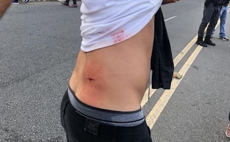 Hincha de Independiente acuchillado en Brasil