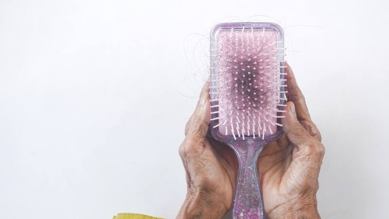 Close-up of an onion, symbolizing the potential hair loss remedy.