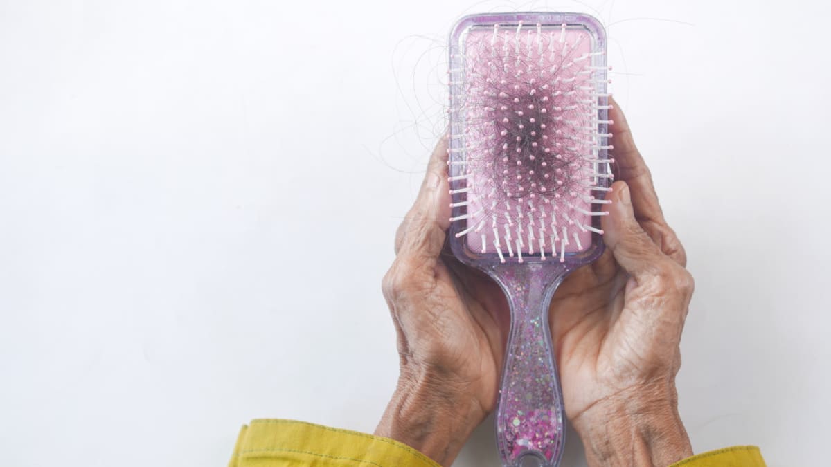 Un freno a la calvicie: los desconocidos beneficios de un alimento contra la caída del cabello