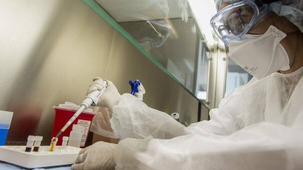 Viruela del mono: hay "altas probabilidades" de que el caso sospechoso en la Argentina sea positivo