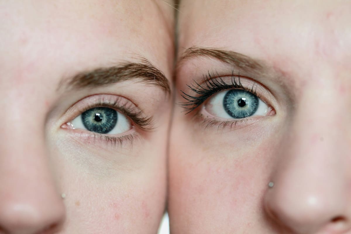 Color de los ojos. Foto: Unsplash