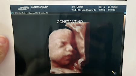 Denuncian a una clínica por entregar la misma foto de la ecografía 5D a todas las pacientes. Foto: Twitter.