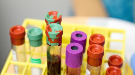 Una molécula de la sangre podría ser la clave para combatir el envejecimiento cerebral. Foto: Unsplash.