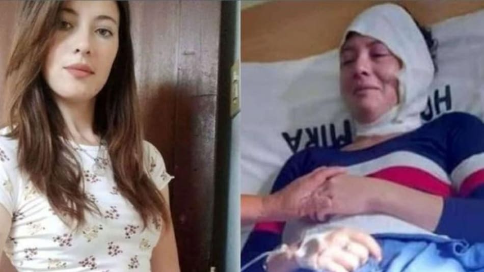 Mujer agredida por su ex, foto Medios de Entre Ríos