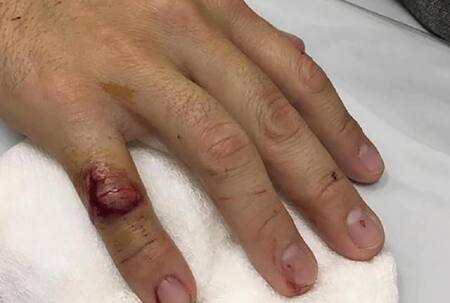 Una patota de ATE intentó tomar un edificio del INTI y agredió a un director del instituto