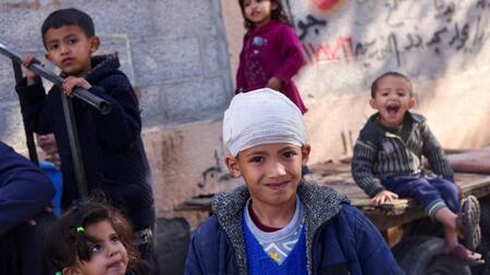 Mysara Abu Telakh, un niño palestino desplazado que resultó herido en un ataque israelí, observa en Rafah. Foto: Reuters