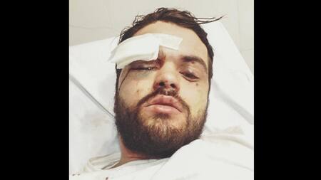 Joven perseguido y golpeado por su condición sexual