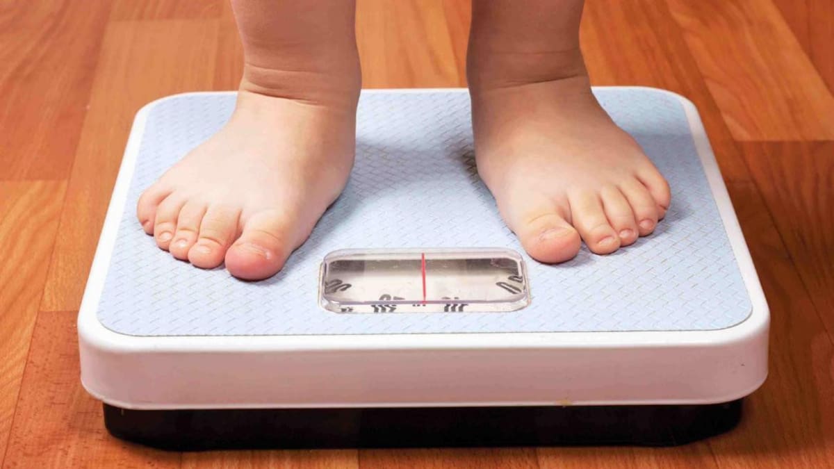 Obesidad infantil, sobrepeso en niños