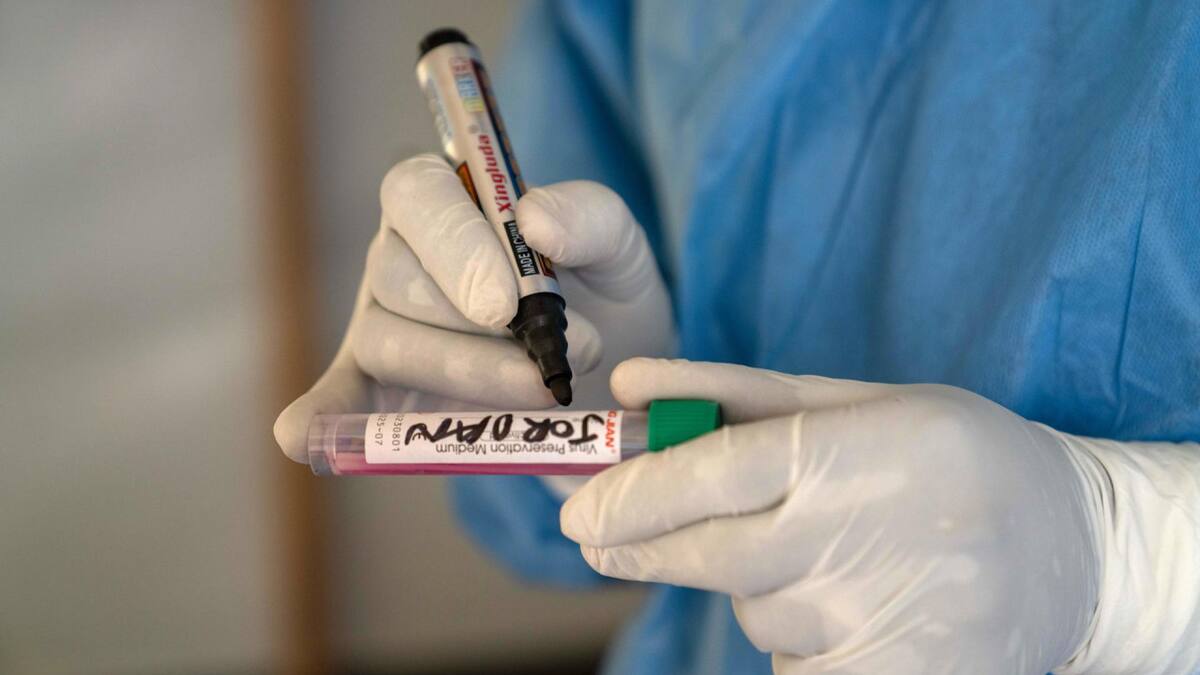 Mpox virus; viruela del mono. Foto: EFE.