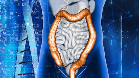 Un estudio relaciona las dietas ricas en calcio con un menor riesgo de cáncer de colon