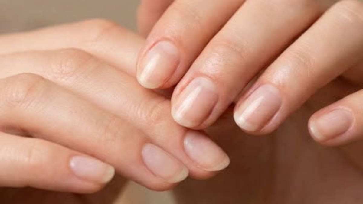 Observar los cambios en las uñas puede salvarte la vida