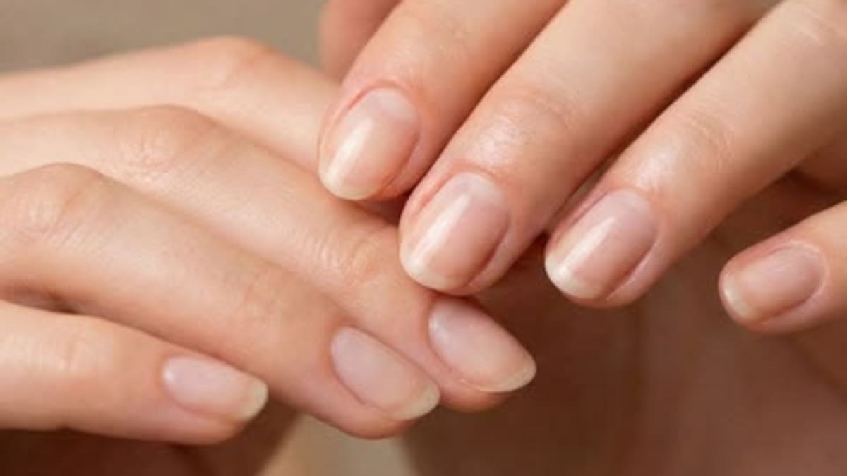 El cambio en las uñas que puede alertar sobre un problema de salud: qué significa y cuándo es importante consultar al médico