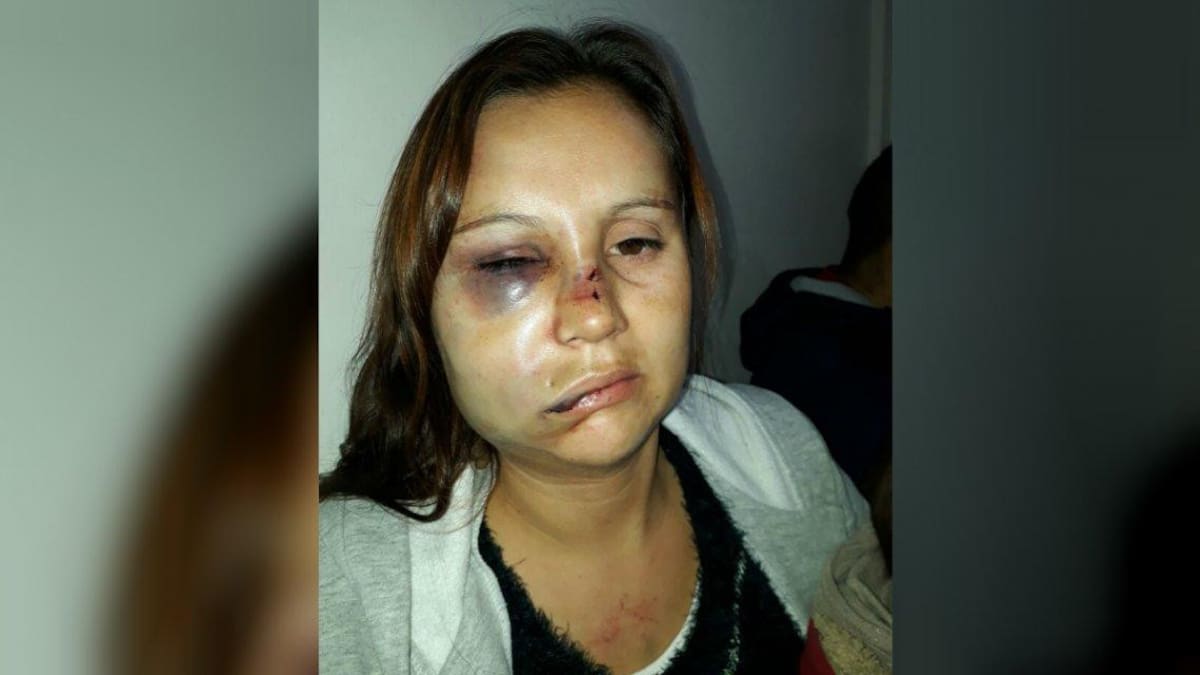 Le desfiguró la cara mientras amamantaba a su hijo: "Sé que quiere matarme"