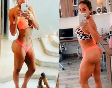 Las operaciones que se hizo la esposa de Lotocki. Foto: Instagram.