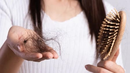 Pelo, caída del pelo, caída del cabello, NA