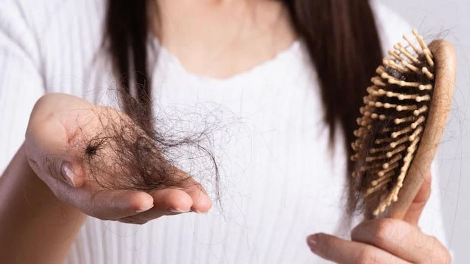 Pelo, caída del pelo, caída del cabello, NA