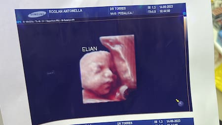 Denuncian a una clínica por entregar la misma foto de la ecografía 5D a todas las pacientes. Foto: Twitter.