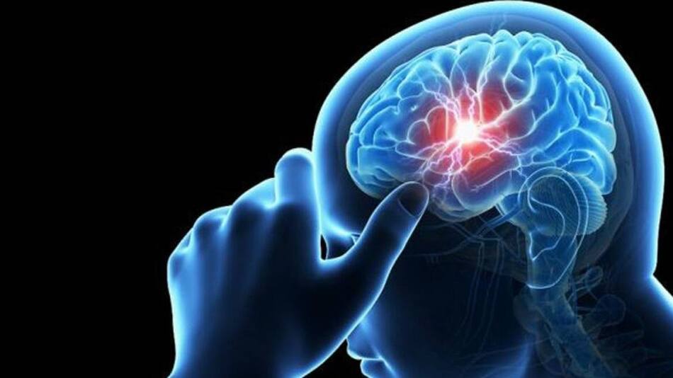 Cerebro.