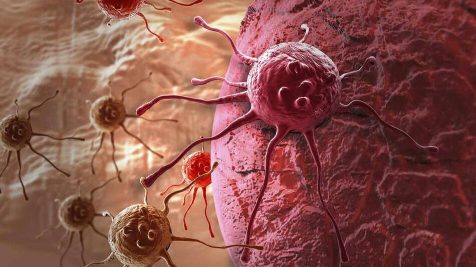 Cancer