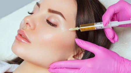 Tratamiento facial de plasma rico en plaquetas.