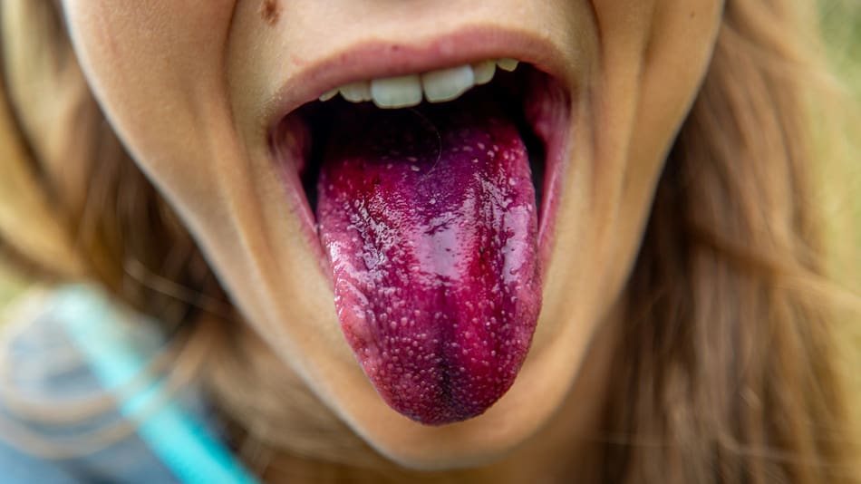 Lengua. Foto: Unsplash