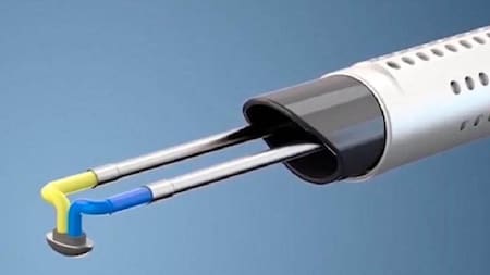 Microcirugía de próstata