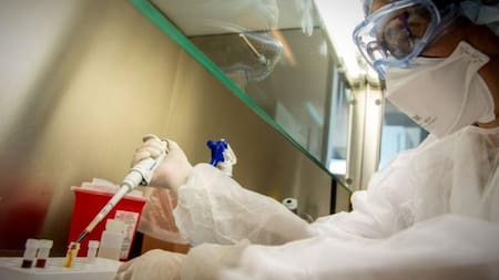 Viruela del mono, enfermedad. Foto: NA.