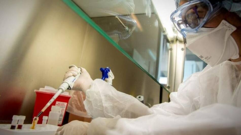 Viruela del mono, enfermedad. Foto: NA.