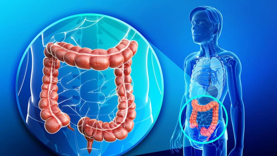 Cáncer colorrectal (Oncology-central.com)