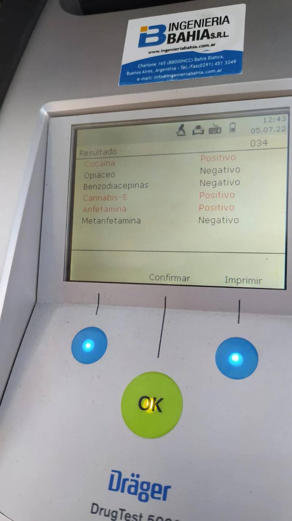 El resultado de una de las pruebas realizadas a Iorio. Foto: Twitter / @MatiasJAguirre - Telefé Bahía Blanca.