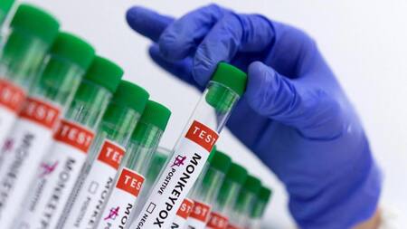 Lucha contra la viruela del mono: Emiratos Árabes envió vacunas a cinco países de África por el brote de mpox