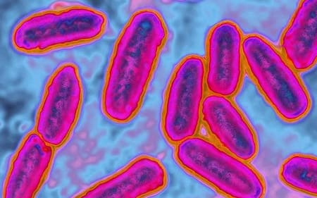 ¿Cuáles son las superbacterias más resistentes? Pseudomonas aeruginosa