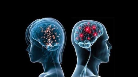 Enfermedad neurológica, cerebro, Parkinson, accidente cerebrovascular (ACV), demencia