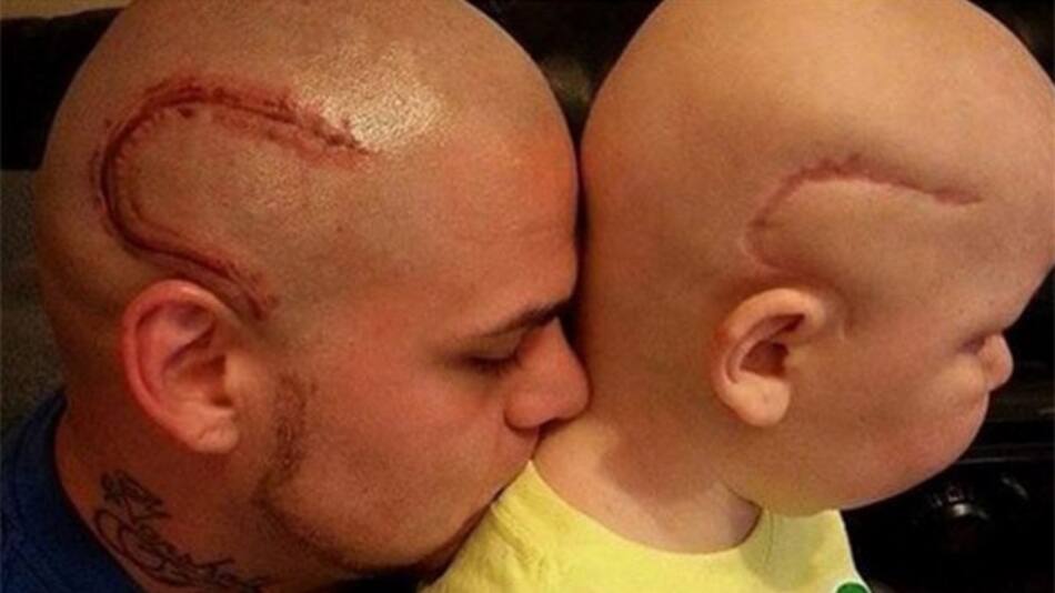 Padre se tatuó cicatriz