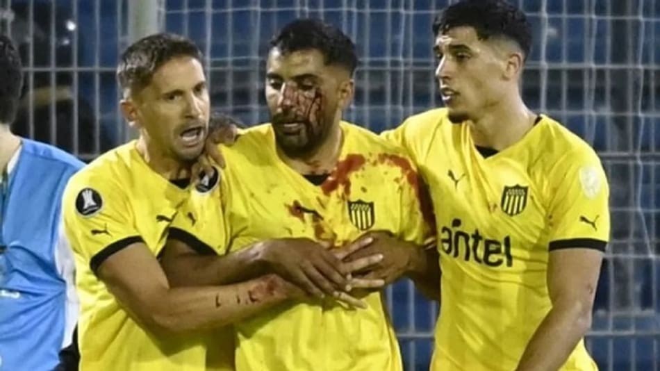 Un jugador de Peñarol fue agredido tras el partido ante Rosario Central. Foto: NA.
