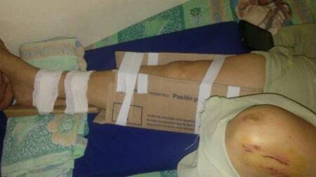 Yeso con cartón y cinta de embalar en Chaco