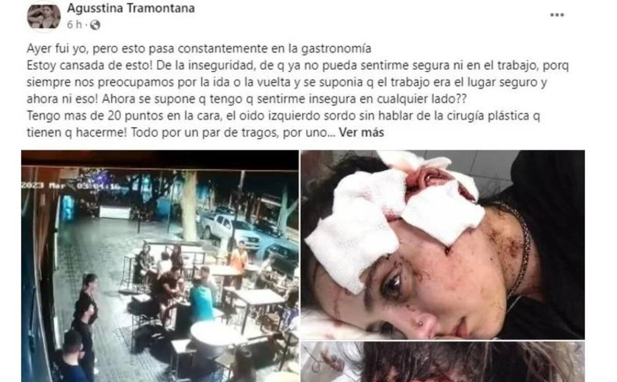 Posteo de la mosa agredida en Mendoza. Foto: Facebook