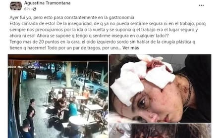 Posteo de la mosa agredida en Mendoza. Foto: Facebook