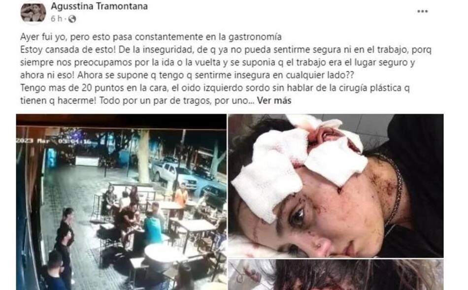 Posteo de la mosa agredida en Mendoza. Foto: Facebook
